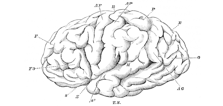 brain2